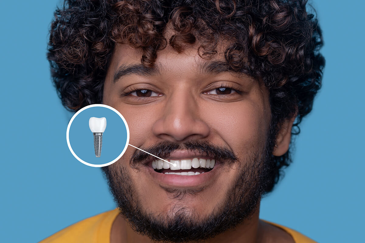 İmplant Tedavisi Herkese Uygulanır mı?