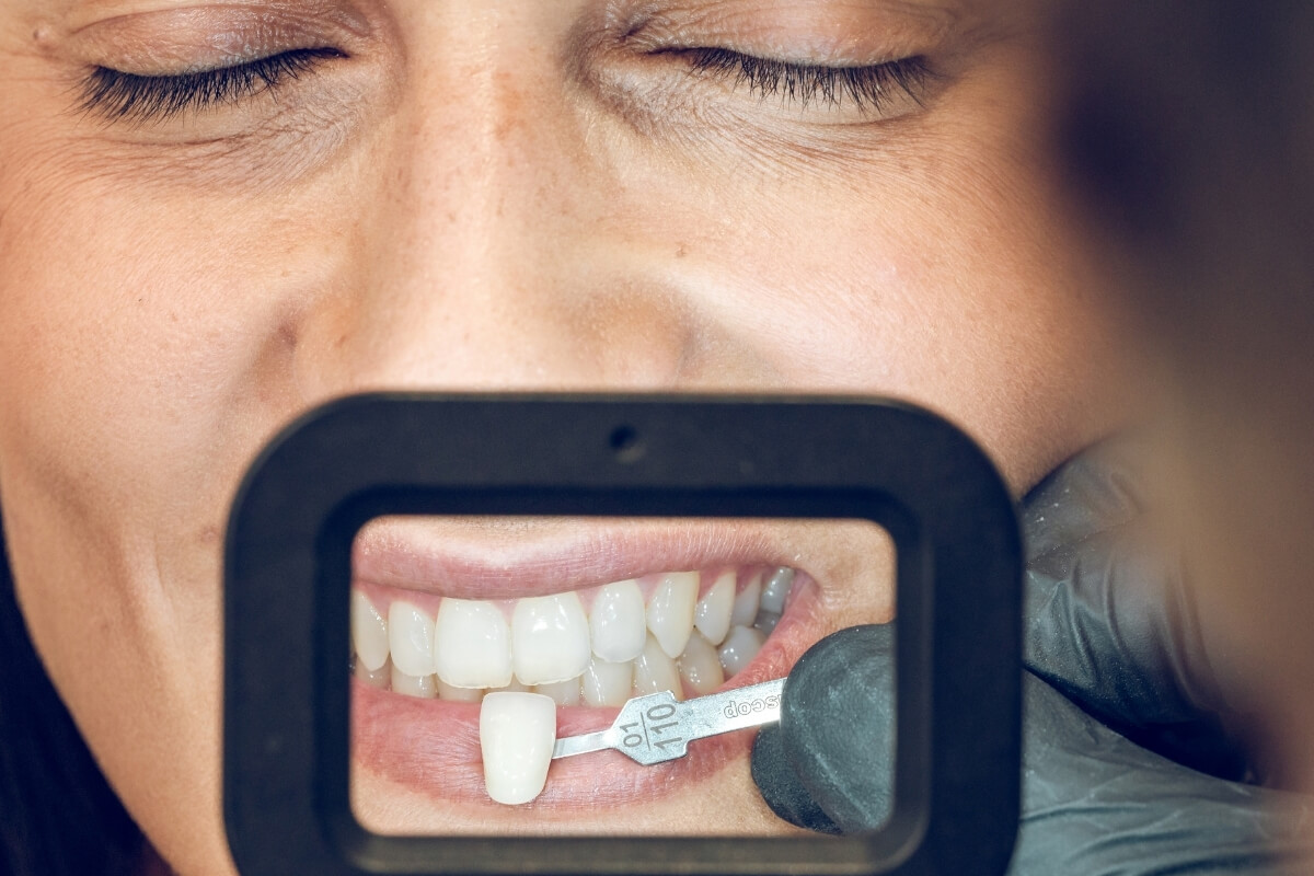 Porselen Lamina Fiyatları 2026