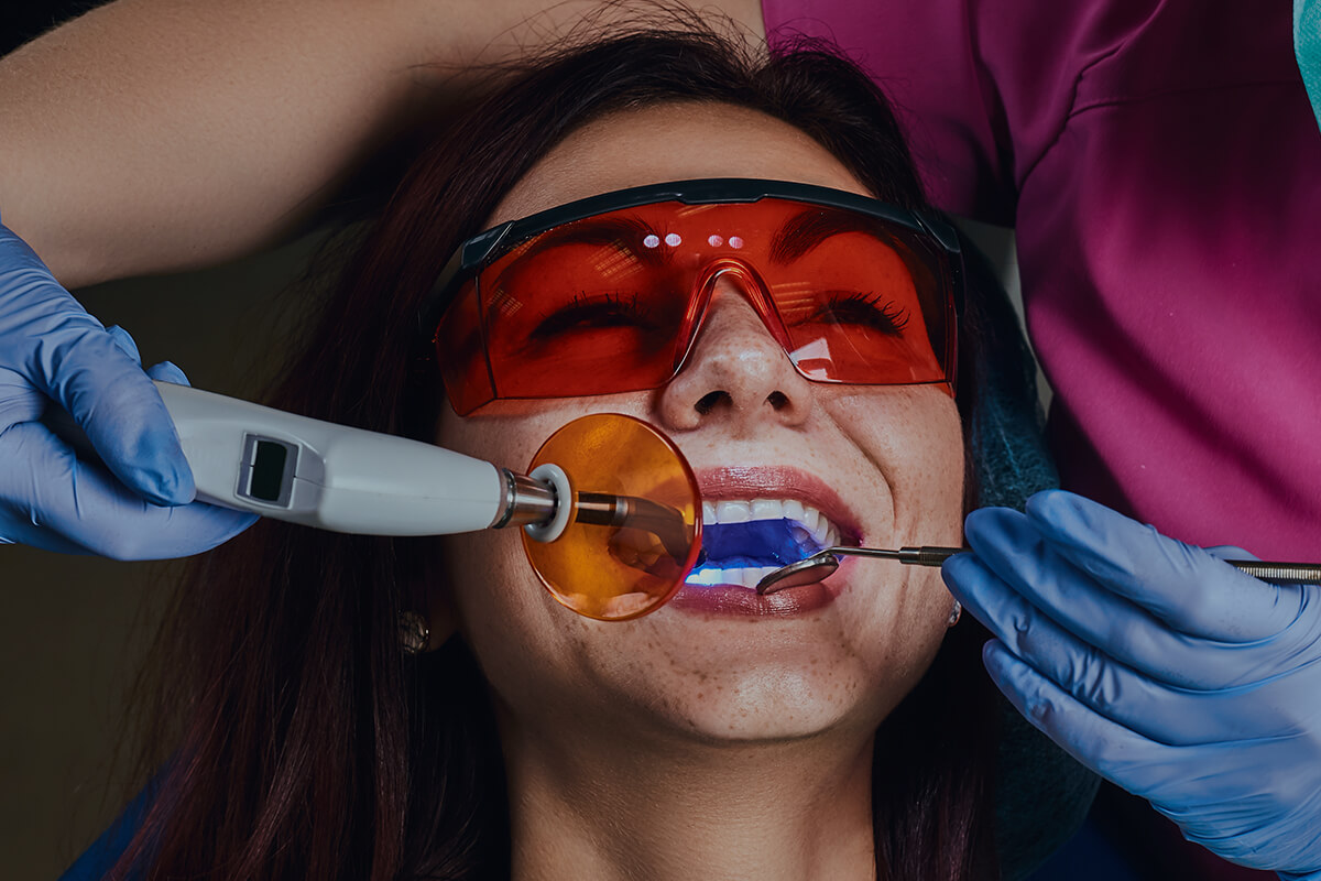 Samsun Diş Beyazlatma (Bleaching)