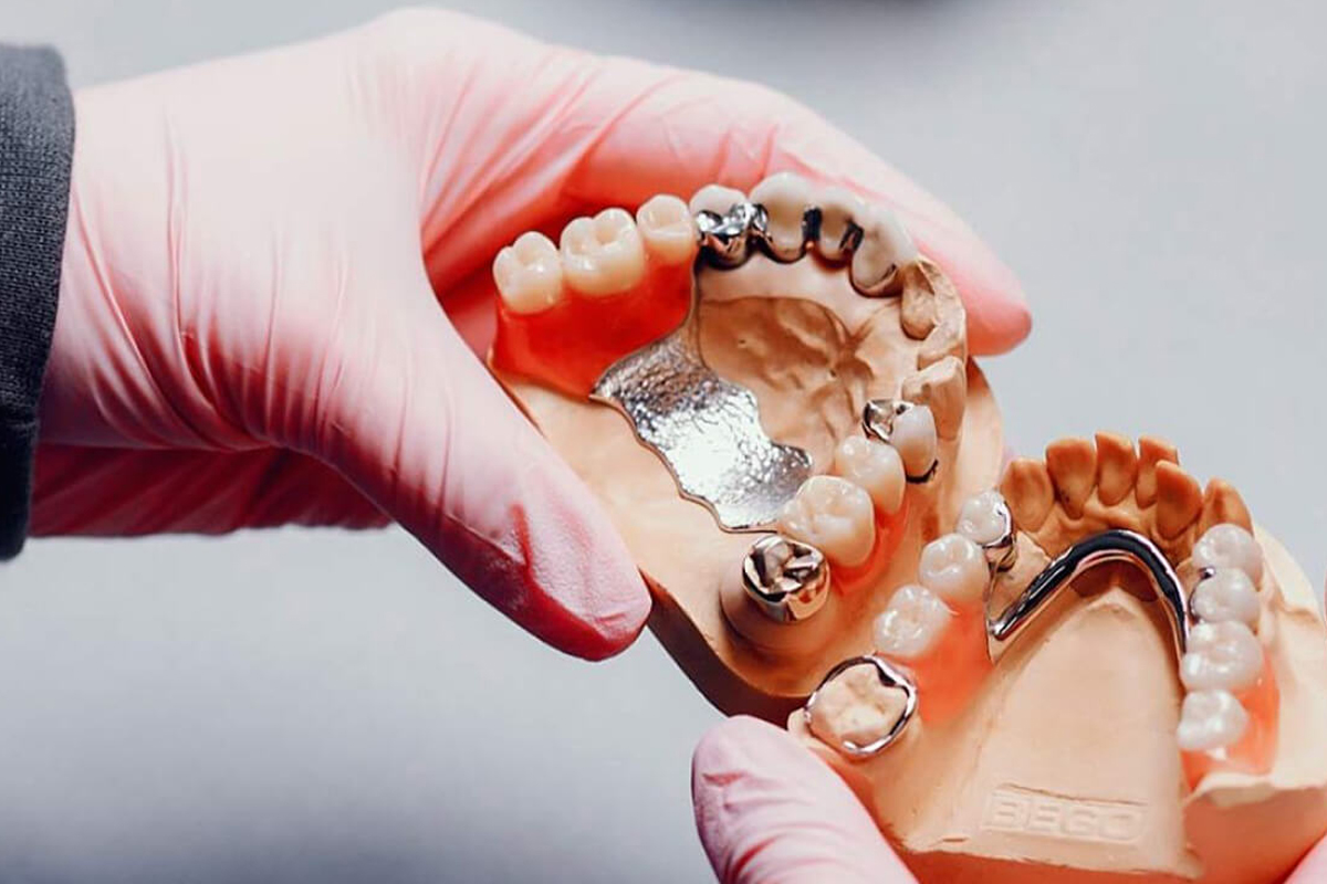 Samsun Diş Protezi Sonuç